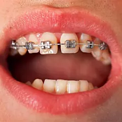 Shop Orthodontie