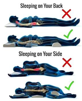 Diagram showing correct and incorrect spinal alignment for back and side sleeping positions